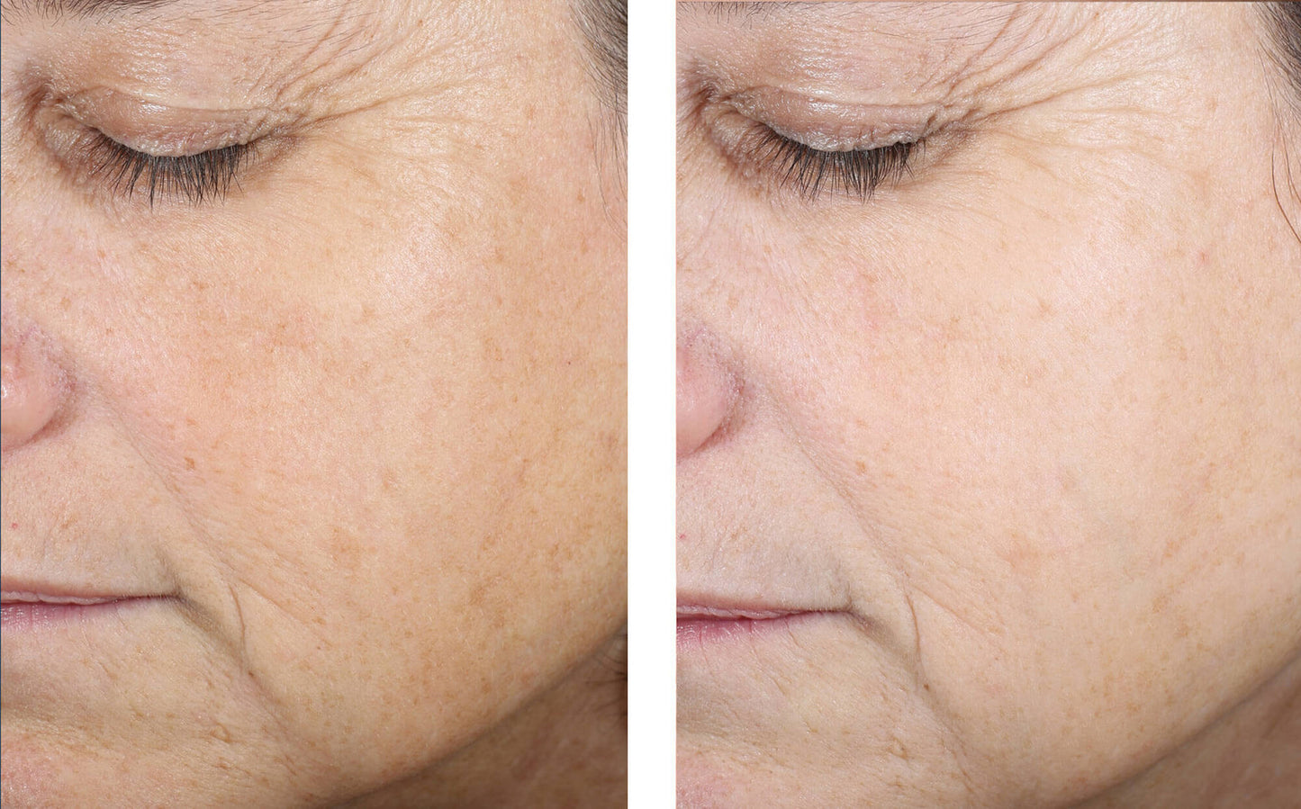 Even Tone Correcting Serum