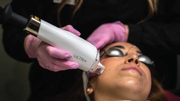 Laser Facials